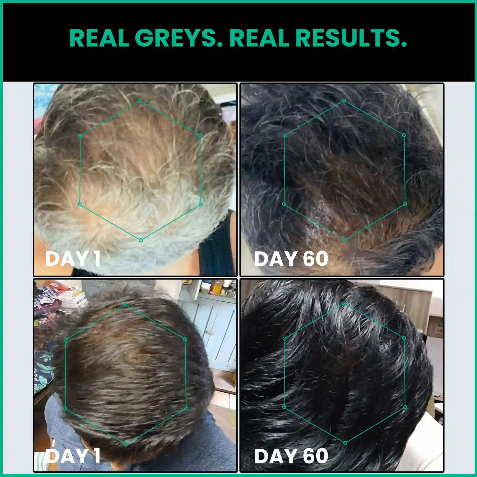 Reverse premature greying with ThriveCo anti-grey hair prime serum