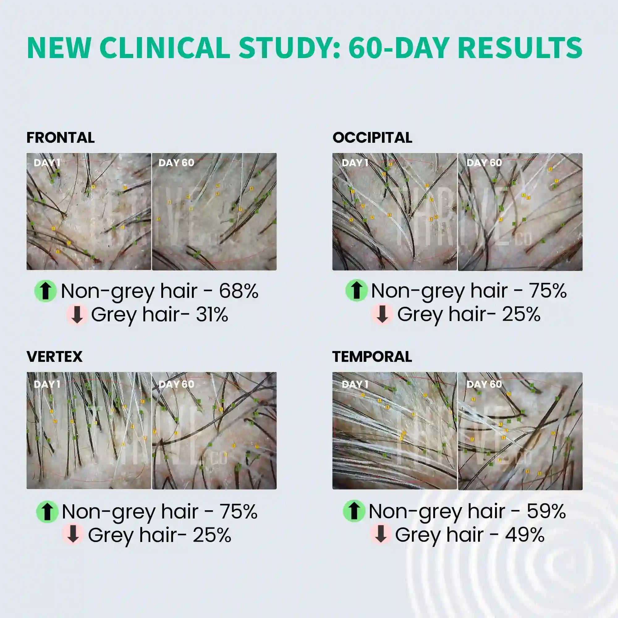 Anti greying hair serum for premature graying