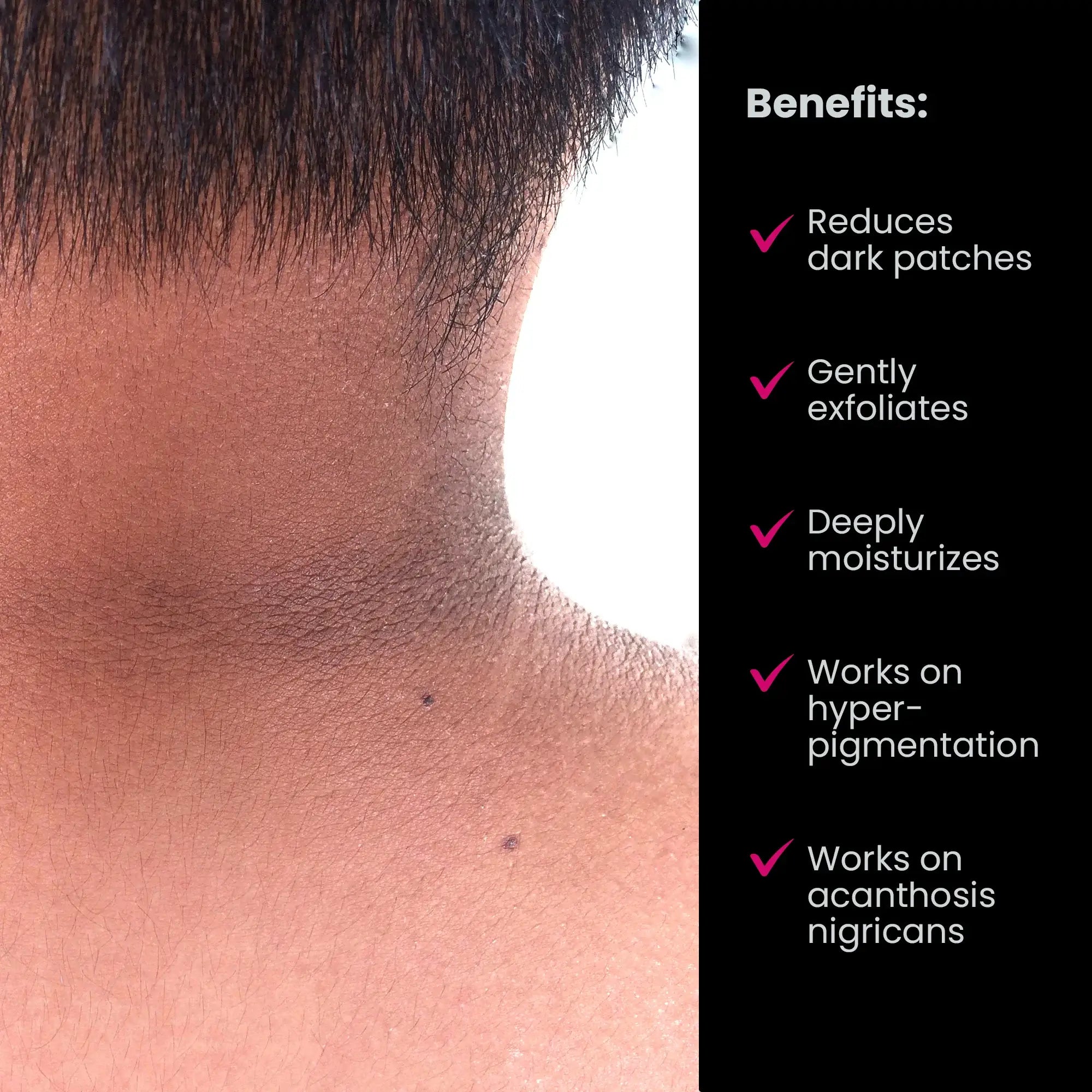 ThriveCo Dark Patches Corrector Dark Spots Removal Cream