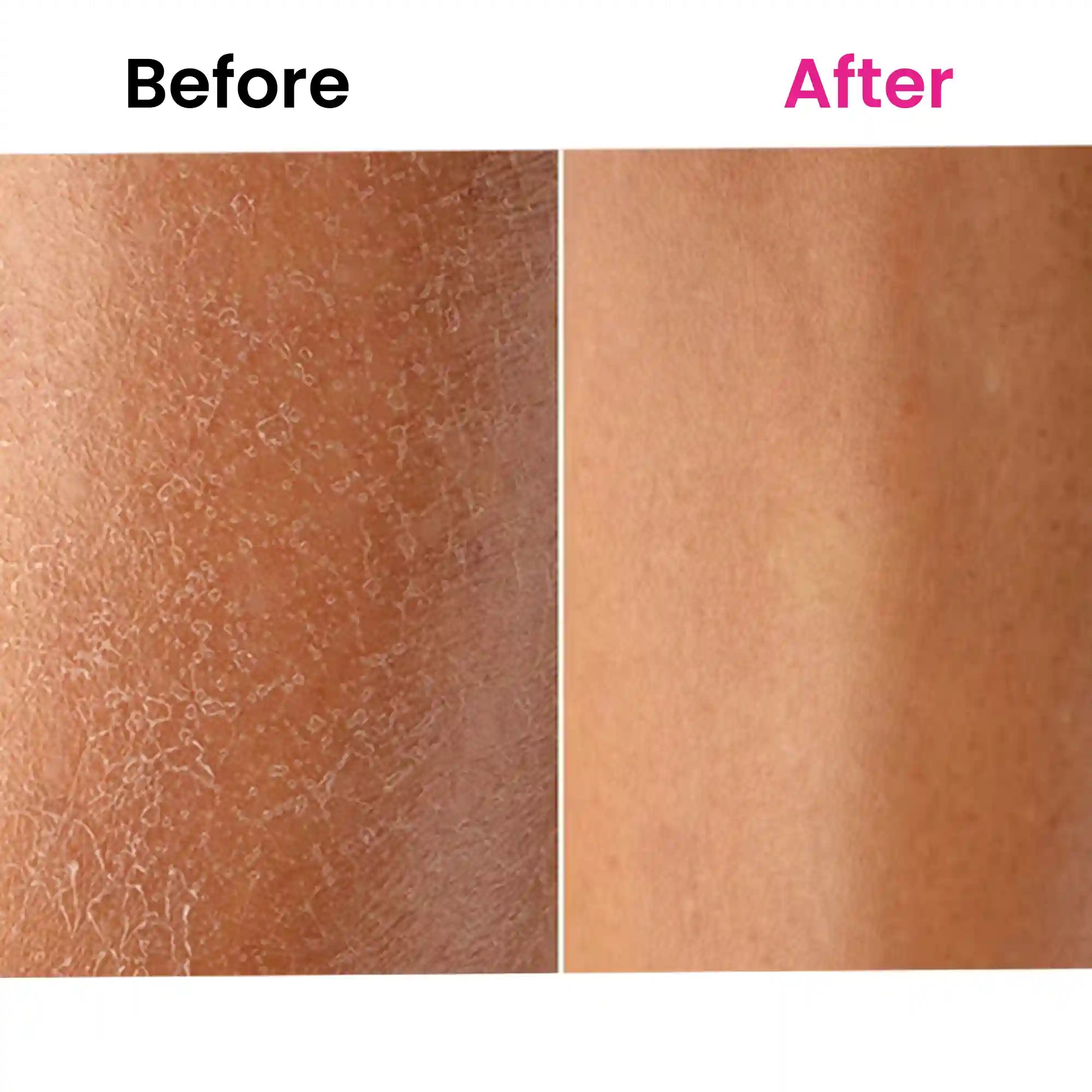 before and after using ThriveCo skin expert skin care oil
