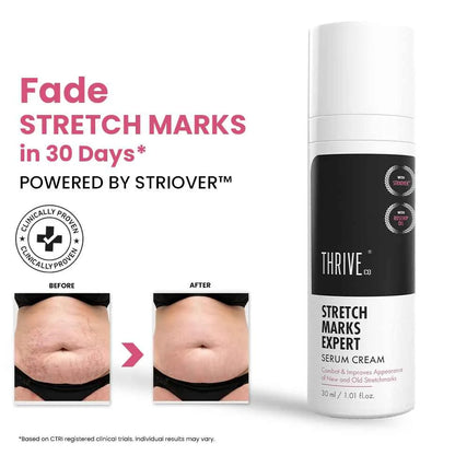 Stretch Marks Expert, Serum Cream, 30ml