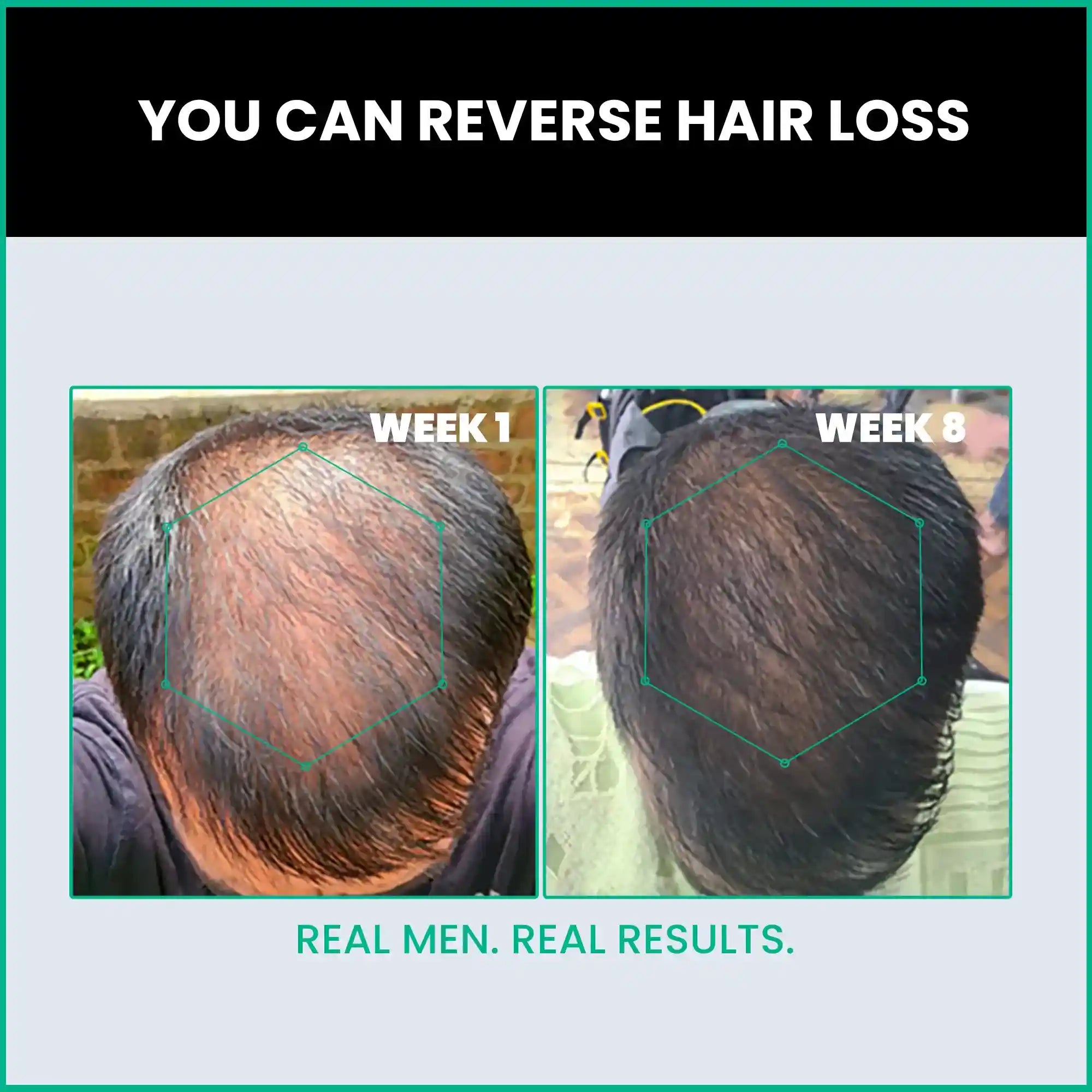Good Hair Women Anti-hair loss - 1 month