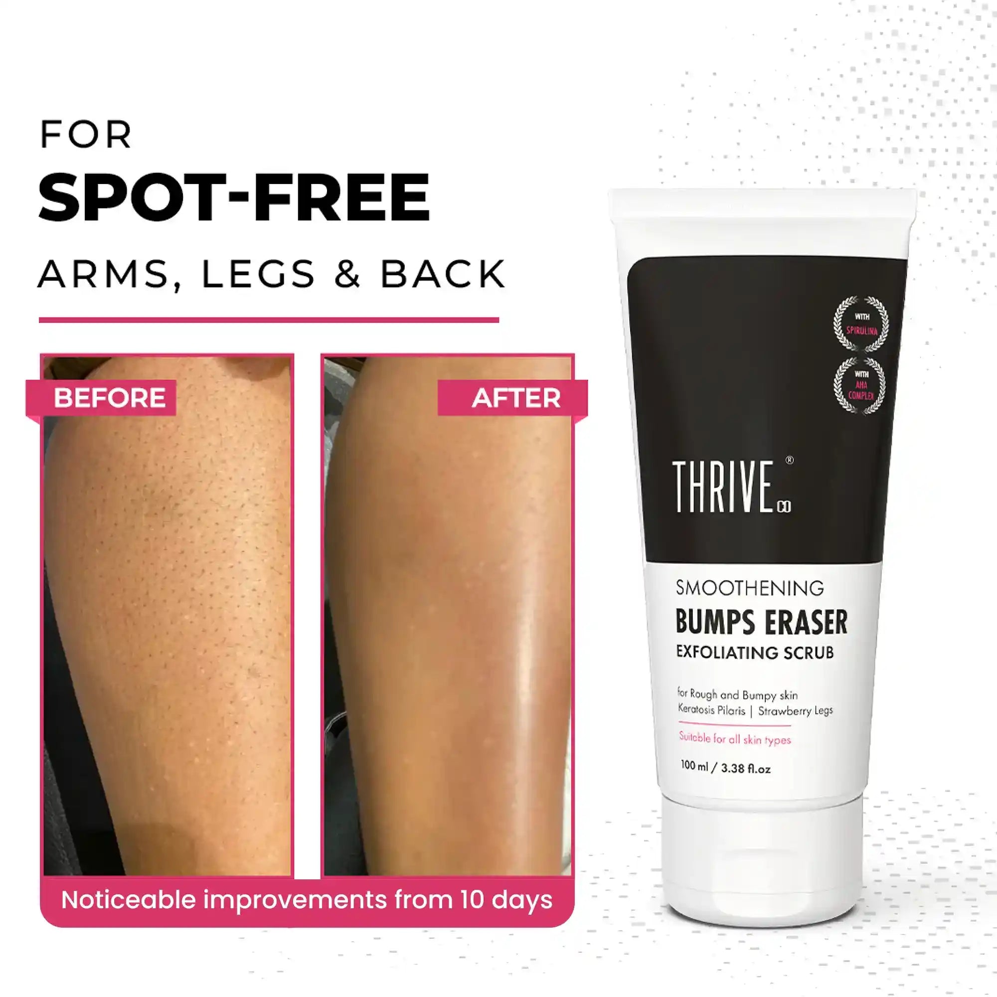 Buy Bumps Eraser Exfoliating Scrub for KP Skin Strawberry Legs