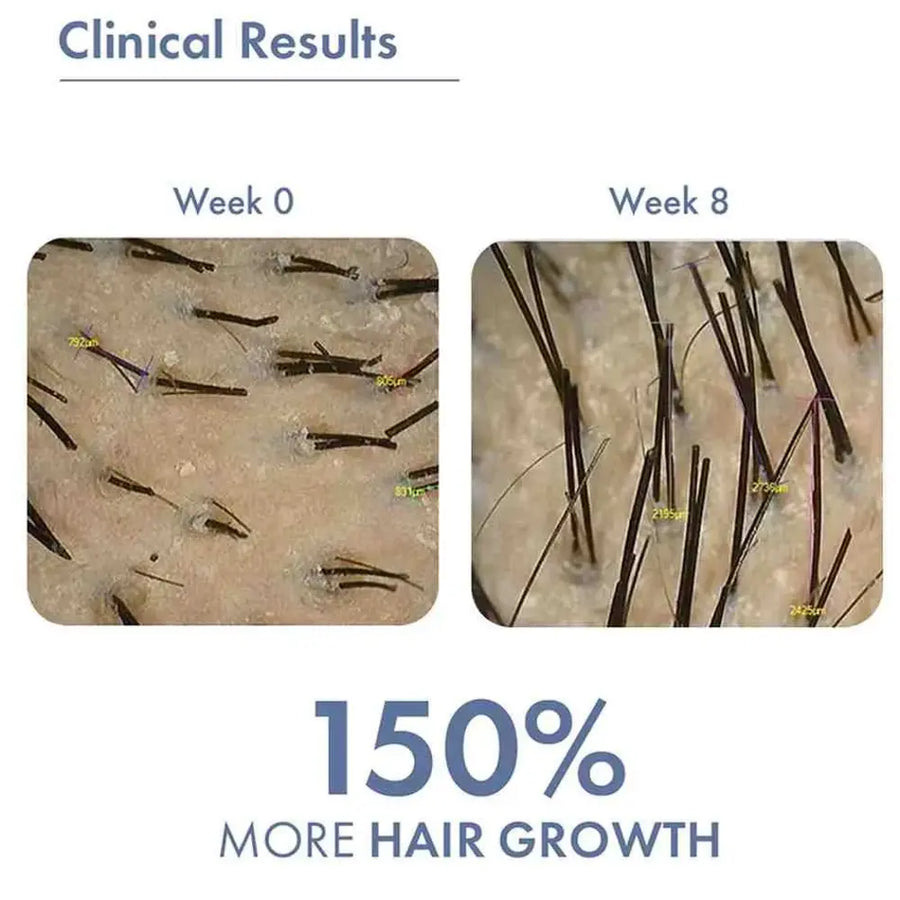 Close-up comparison of scalp images. Left: sparse hair at Week 0. Right: denser hair at Week 8 stating 150% more hair growth.