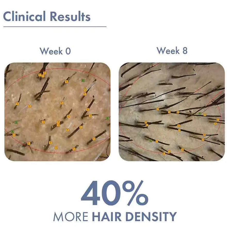 Clinical results image showing two close-up scalp views. Week 0 with sparse hair, Week 8 with denser growth claiming 40% more hair density.