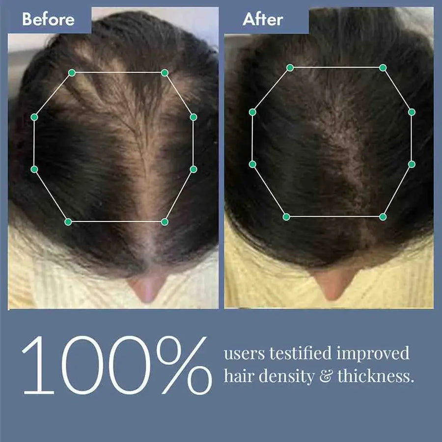 efore-and-after image showing increased hair density on a woman's scalp, testifying 100% users improved hair density & thickness.