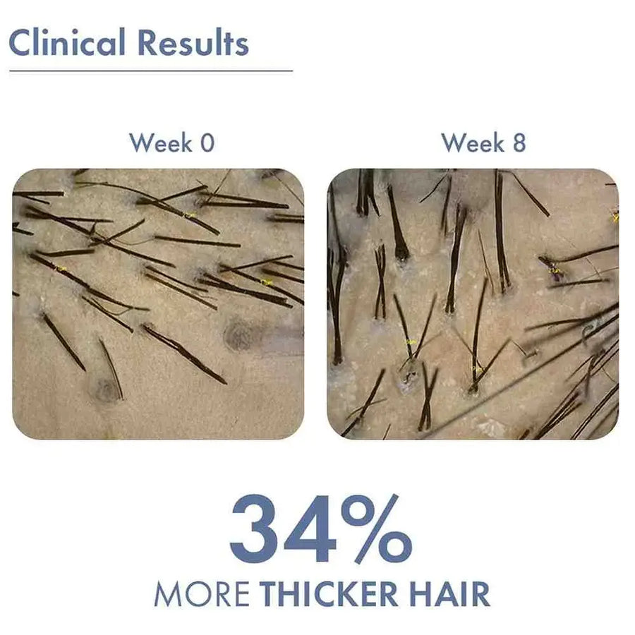 Clinical results showing hair growth over eight weeks. Week 0: sparse hair; Week 8: visibly thicker and denser hair corresponding to 34% more thicker hair.