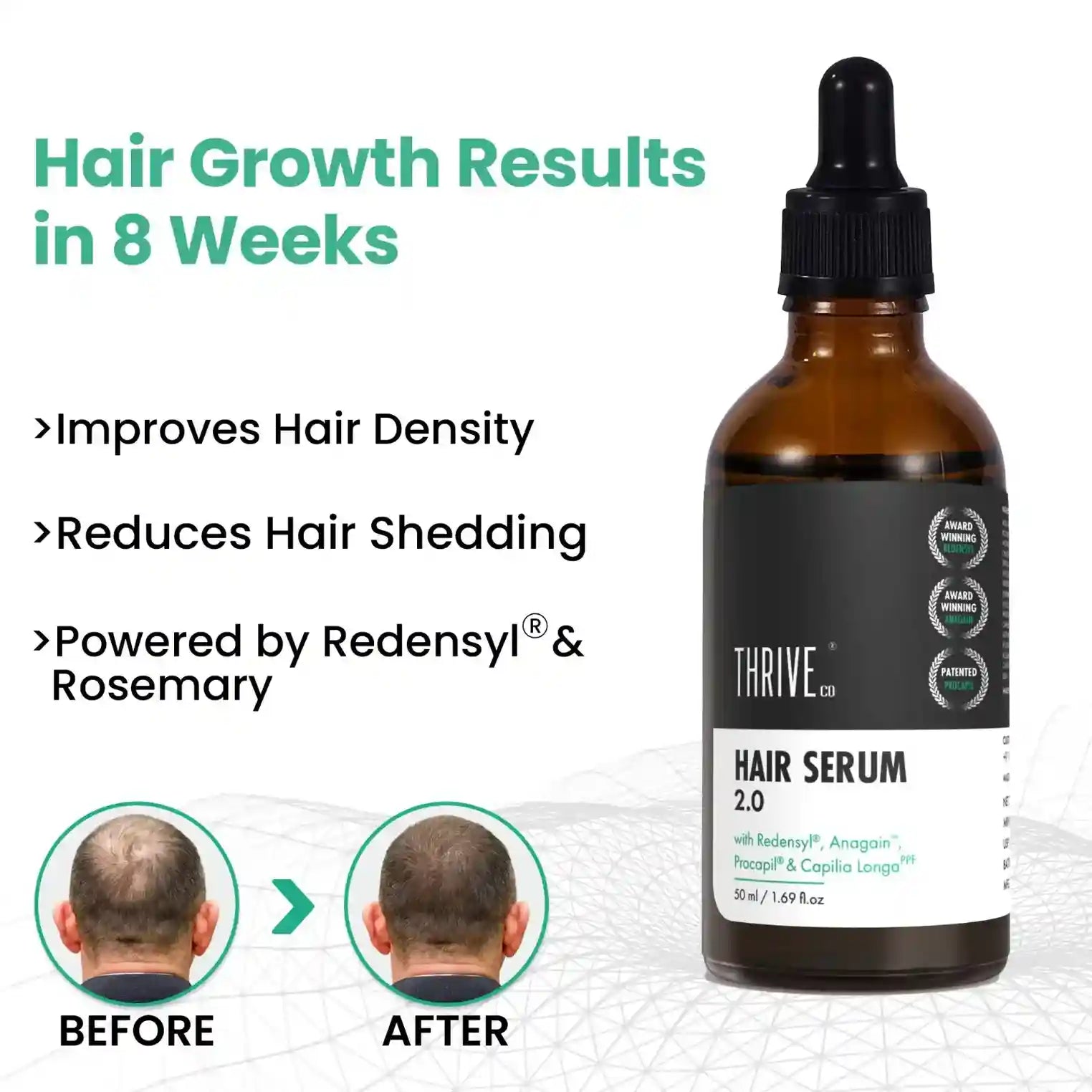 hair growth serum with redensyl anagain procapil for hairfall control