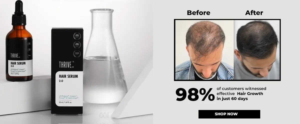 Achieve hair regrowth in just 60 days with ThriveCo Hair Growth Serum 2.0