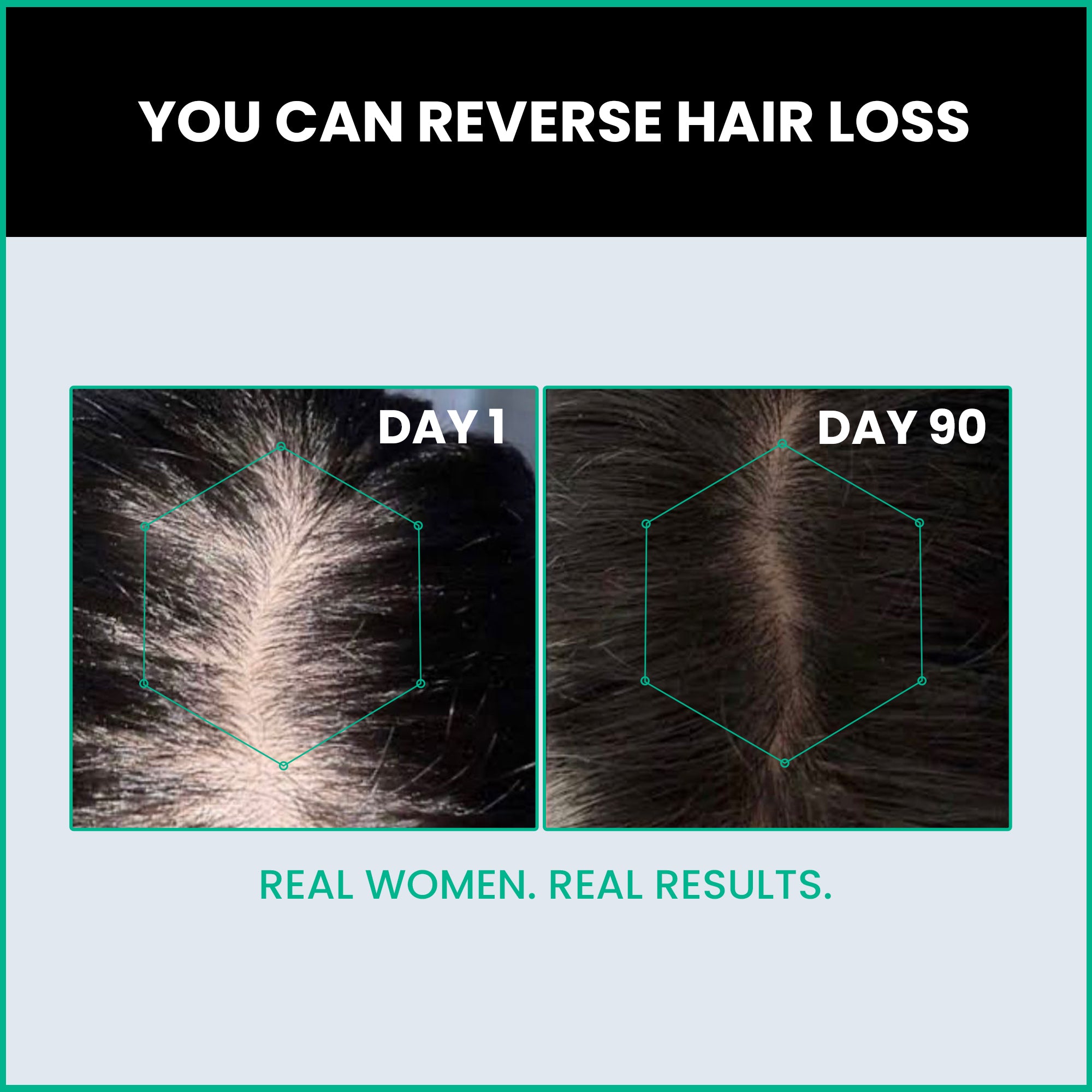 ThriveCo Hair Growth Serum 2.0 For Women For Denser & Thicker Hair