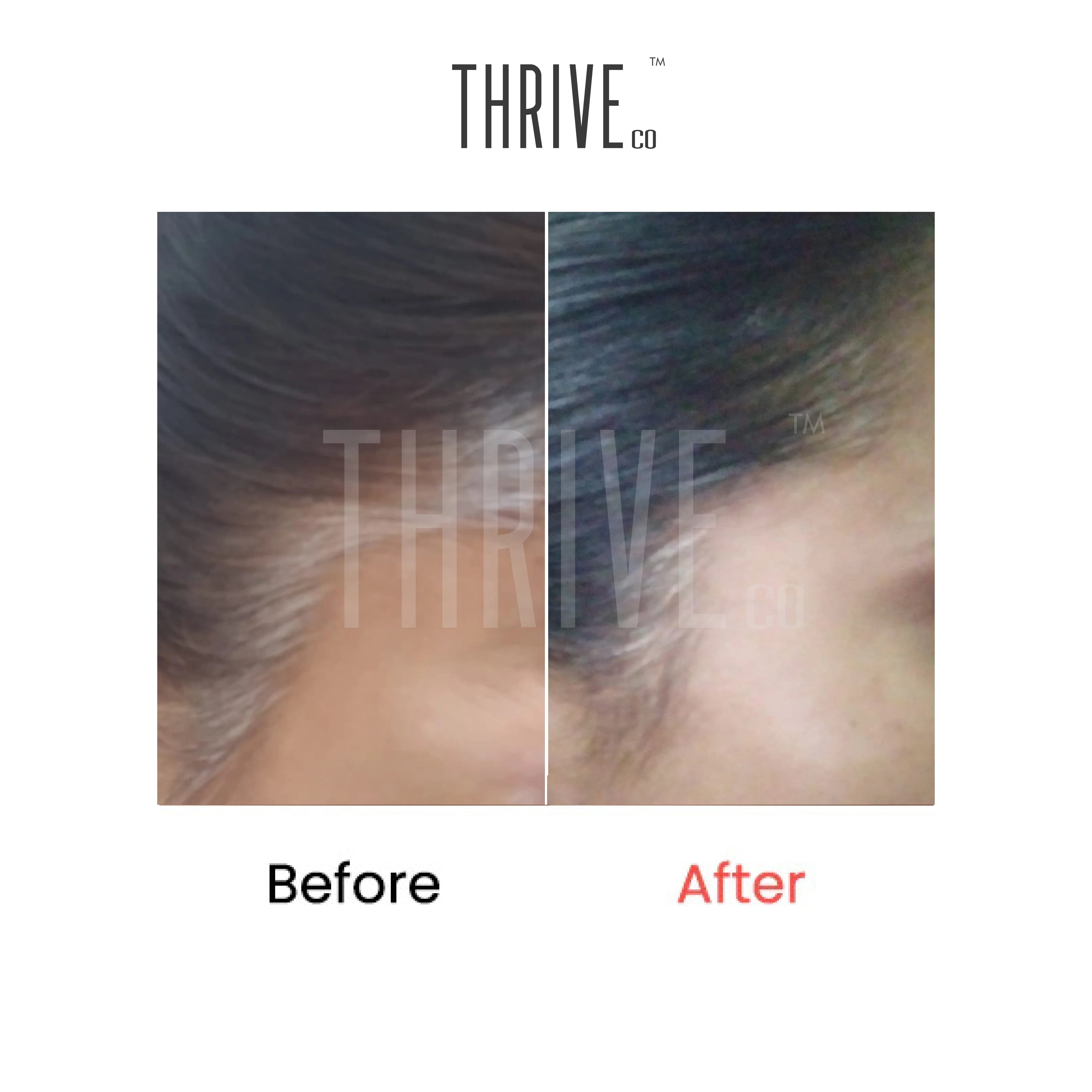ThriveCo Anti Greying Hair Prime Serum with Arcolys