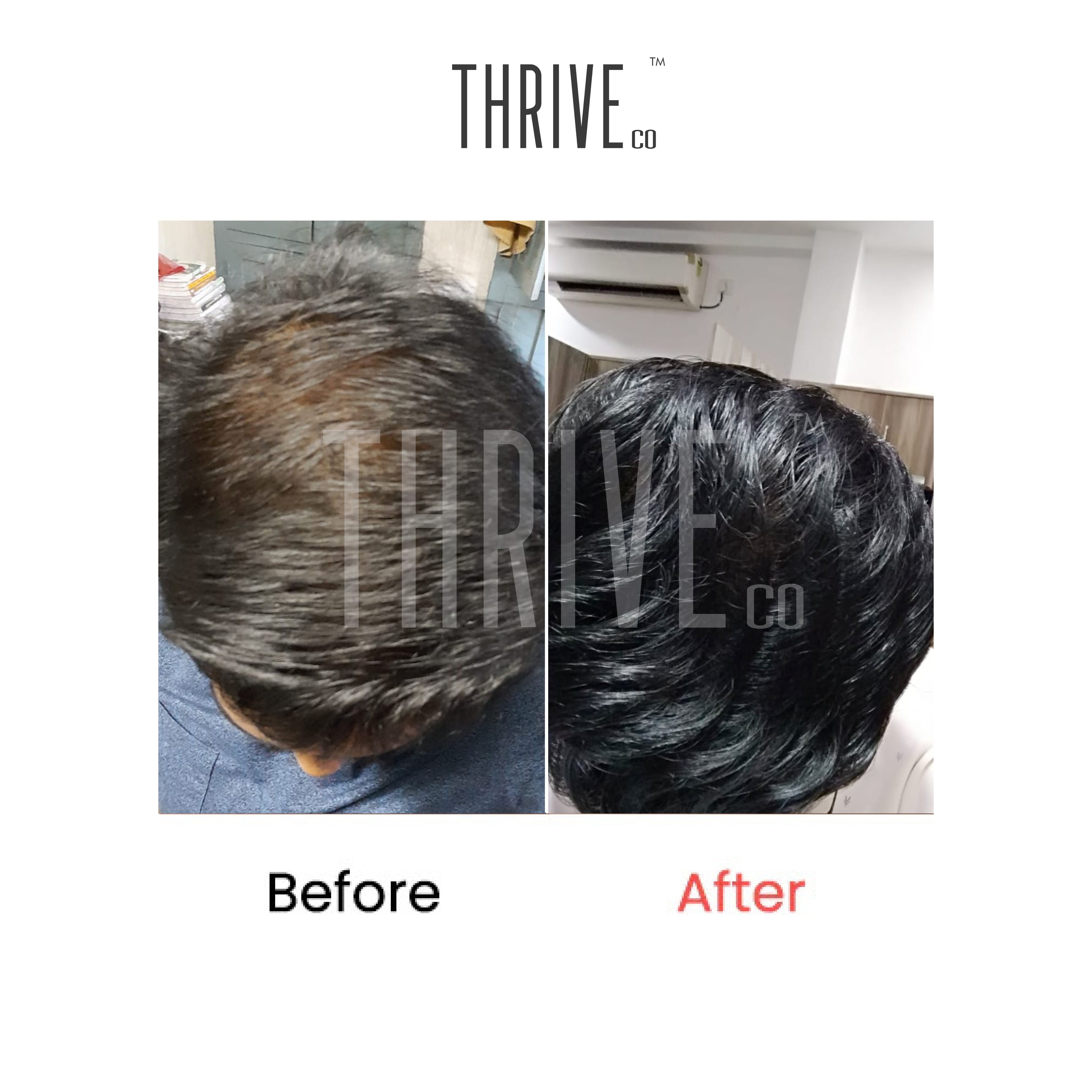 ThriveCo Hair Care Kit: ThriveCo Scalp Scrub (100ml) + Vitalizing Serum (50ml) + Hair Growth Serum (50ml)