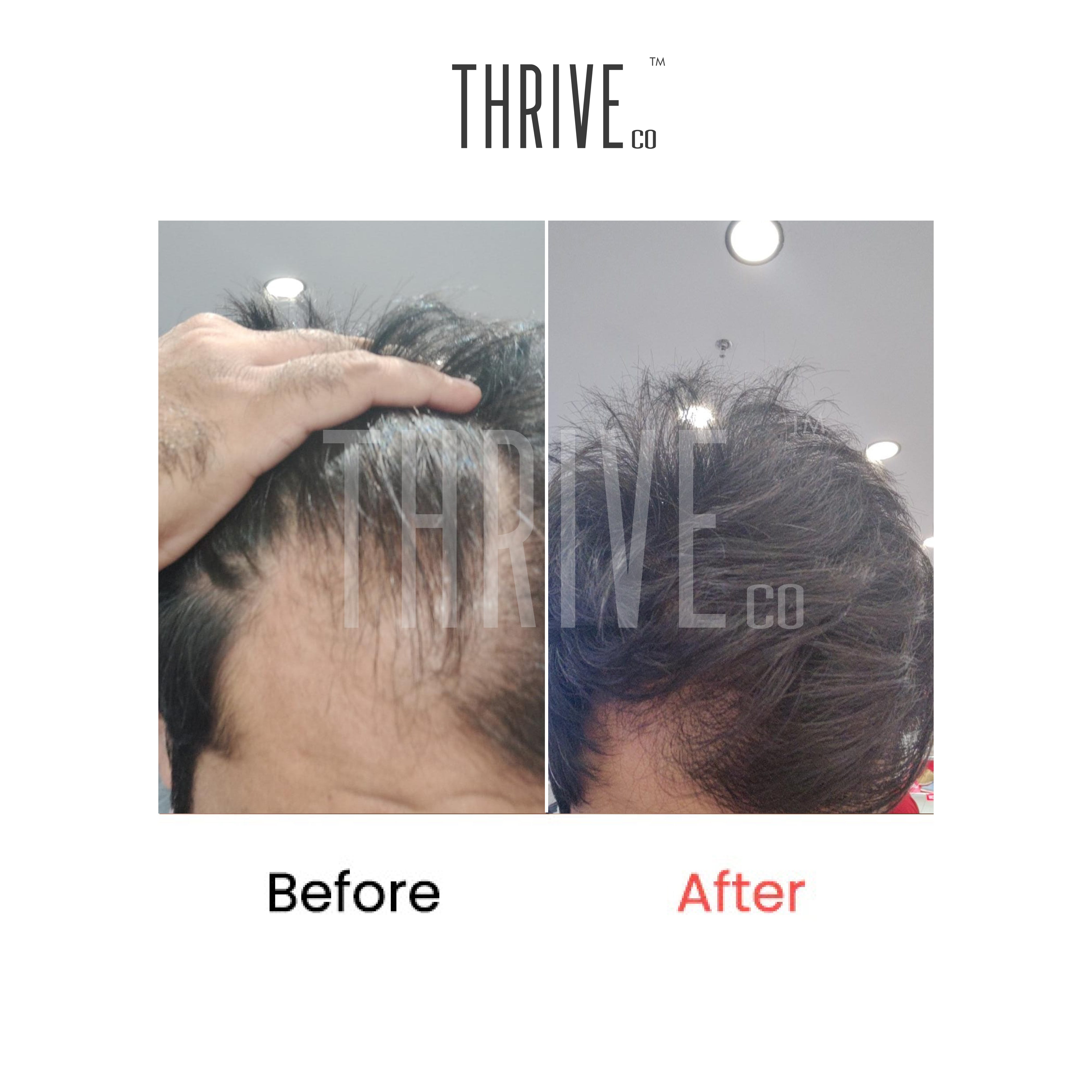 ThriveCo Hair Care Kit: ThriveCo Scalp Scrub (100ml) + Vitalizing Serum (50ml) + Hair Growth Serum (50ml)