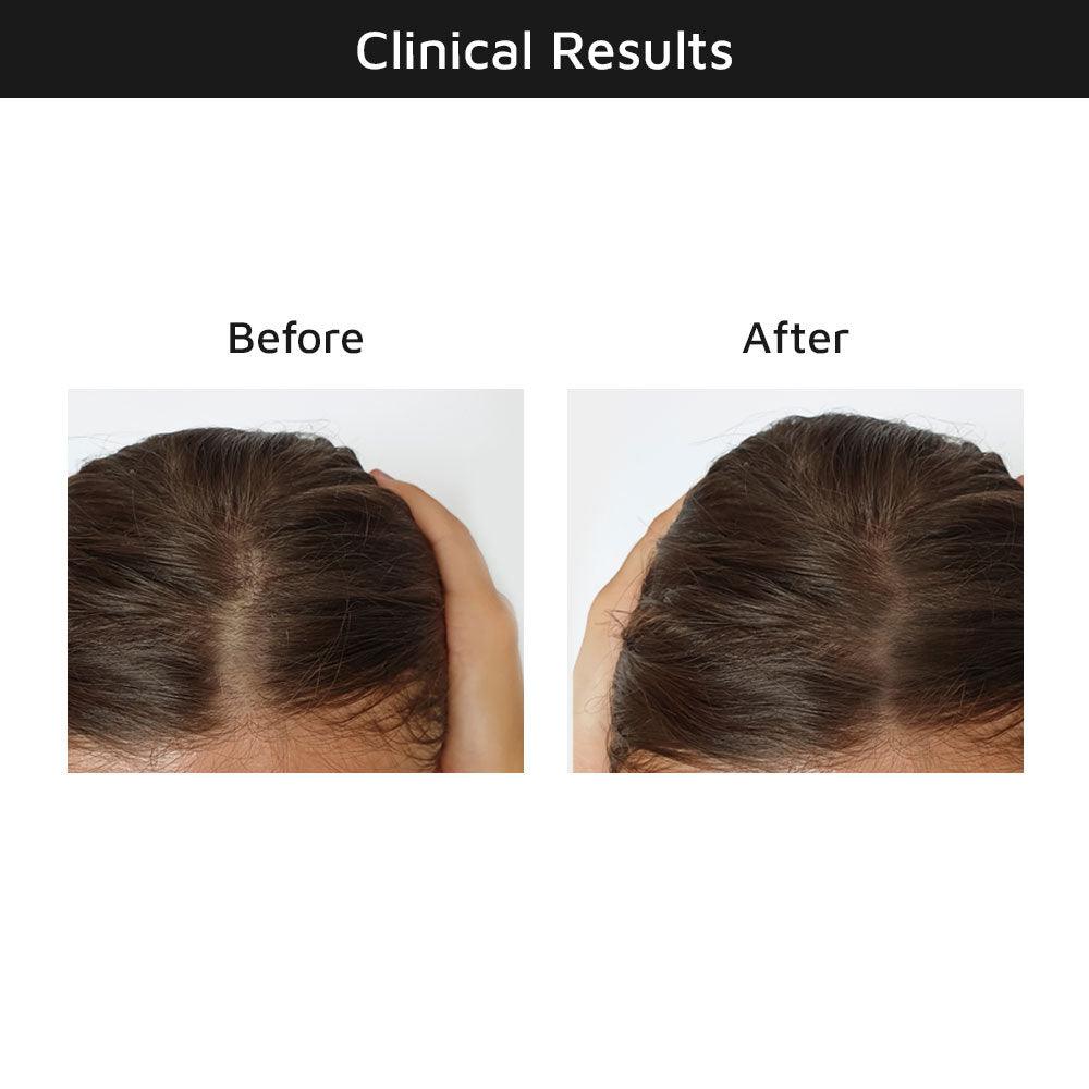 Hair Growth Serum Before & After