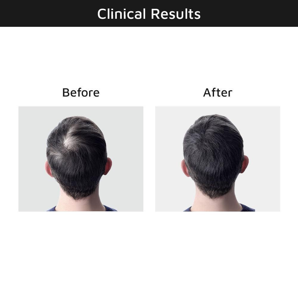 Thrive Hair Growth Serum Clinical Results