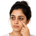 Dark Circles