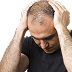 Hair Fall